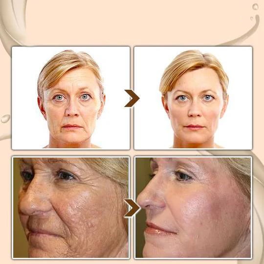 🔥LAST DAY 49% OFF- [Dr.Meloxin Official] Cemenrete Calcium Multi Balm | Anti-aging, Sagging, Wrinkles 💫
