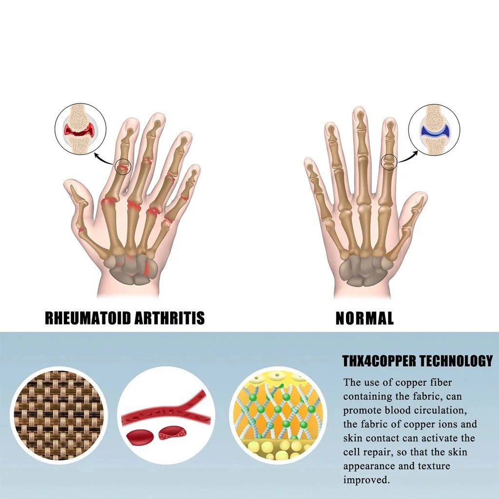 🔥LAST DAY 49% OFF- Arthritis Compression Gloves  – Pain Relief and Support